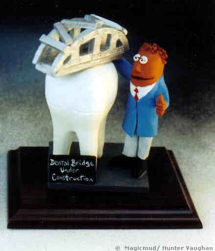 "Dental Bridge Under Construction" Figurine
